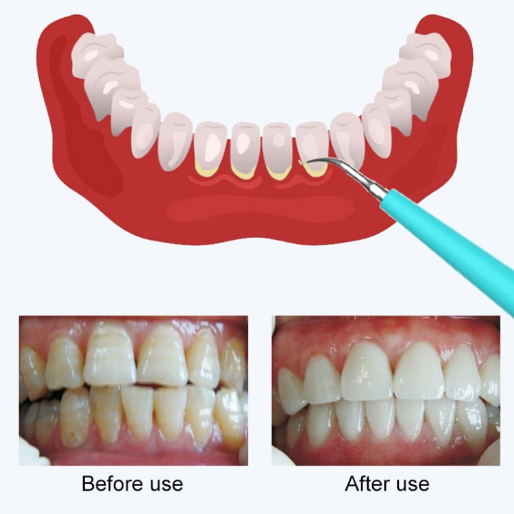 LSHOW YJK015A 3.7V USB Charging Five-speed Mode Waterproof Household Electric High-frequency Vibration Teeth Polisher LSHOW YJK015A 3.7V USB Charging Five-speed Mode Waterproof Household Electric High-frequency Vibration Teeth Polisher