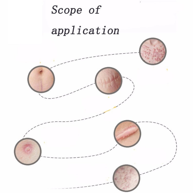 Organic silicone Gel Scar Therapy Patch  be Washed and Reused Organic silicone Gel Scar Therapy Patch  be Washed and Reused