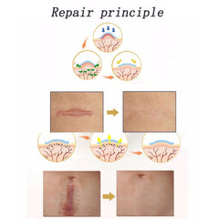Organic silicone Gel Scar Therapy Patch  be Washed and Reused
