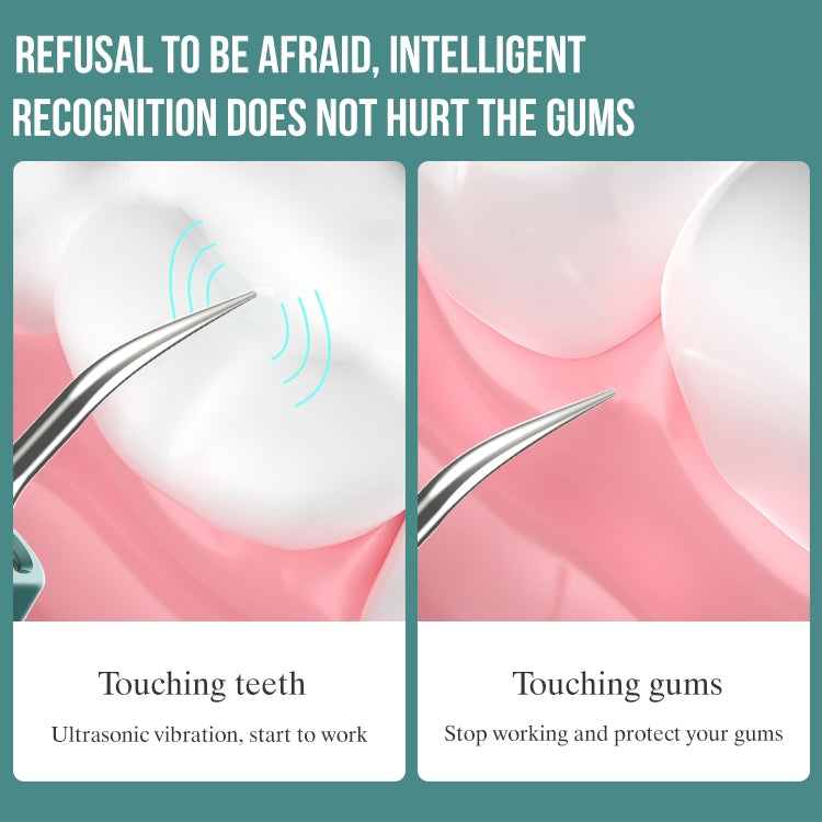 FY-B700 Visual Ultrasonic Scaler Tartar Calculus Tooth Stain Remover Dental Beauty Instrument FY-B700 Visual Ultrasonic Scaler Tartar Calculus Tooth Stain Remover Dental Beauty Instrument