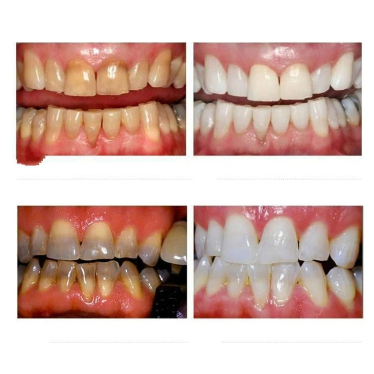 Professional Nano Teeth Whitening Oral Cleansing Set Professional Nano Teeth Whitening Oral Cleansing Set