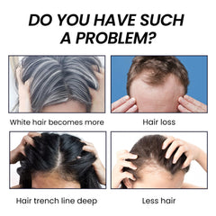 EELHOE Hair Growth Serum - Anti Hair Loss Treatment with Natural Botanicals | 30ml