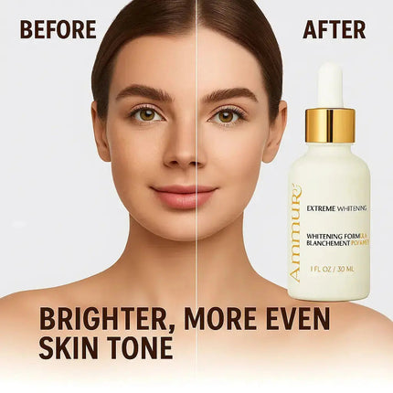 Intense Dark Spot Corrector Serum for Face, Neck & Body (30ml) | Ammuri