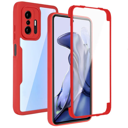 Acrylic + TPU 360 Degrees Full Coverage Shockproof Phone Case, For Xiaomi Mi 11, For Xiaomi Mi 11 Lite, For Xiaomi Mi 11T / 11T Pro, For Xiaomi Redmi Note 11 5G China