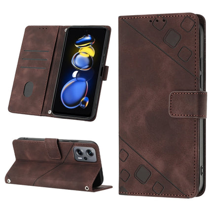 Skin-feel Embossed Leather Phone Case, For Xiaomi Redmi Note 11 Pro 5G / 4G, For Xiaomi Redmi Note 11s / 11 4G, For Xiaomi Redmi Note 11T Pro 5G / 11T Pro+ 5G