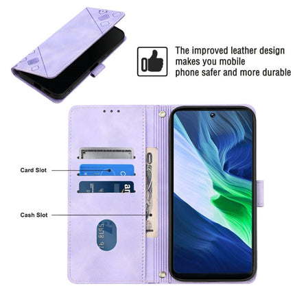 Skin-feel Embossed Leather Phone Case, For Infinix Note 11i / Note 10, For Infinix Note 11s / Note 11 Pro, For Infinix Note 12 G96, For Infinix Note 12 Pro 4G