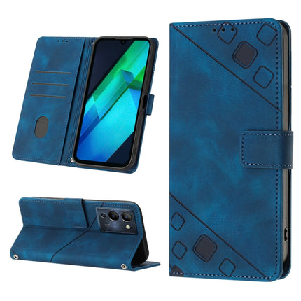 Skin-feel Embossed Leather Phone Case, For Infinix Note 11i / Note 10, For Infinix Note 11s / Note 11 Pro, For Infinix Note 12 G96, For Infinix Note 12 Pro 4G