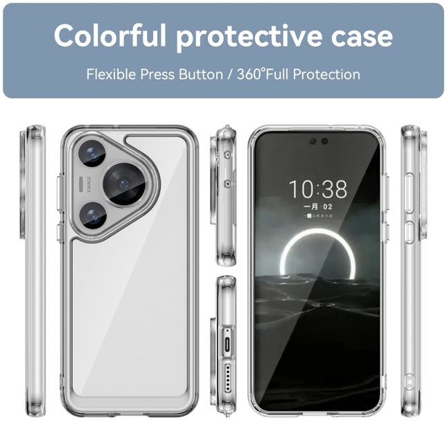 Colorful Series Acrylic + TPU Phone Case, For Huawei Pura 70 Pro+, For Huawei nova 12s, For Huawei Pura 70 Pro, For Huawei Pura 70