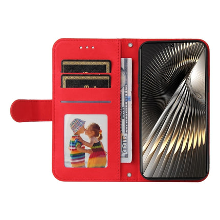 Skin Feel Life Tree Metal Button Leather Phone Case, For Xiaomi Poco F6, For Xiaomi Redmi A3, For Xiaomi Redmi Note13 Pro 4G Global/Poco M6 Pro 4G, For Xiaomi Redmi Note13 4G