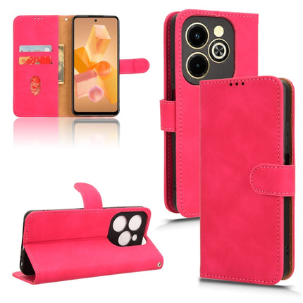 Skin Feel Magnetic Flip Leather Phone Case, For Infinix Hot 40i, For Infinix Smart 8, For Infinix Zero 30 5G, For Infinix GT 10 Pro