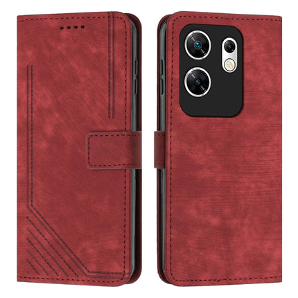 Skin Feel Stripe Pattern Leather Phone Case with Lanyard, For Infinix Zero 30 4G, For Infinix Zero 30 5G, For Infinix Hot 30 Play NFC, For Infinix Note 30/Note 30 5G