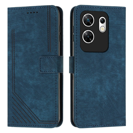 Skin Feel Stripe Pattern Leather Phone Case with Lanyard, For Infinix Zero 30 4G, For Infinix Zero 30 5G, For Infinix Hot 30 Play NFC, For Infinix Note 30/Note 30 5G