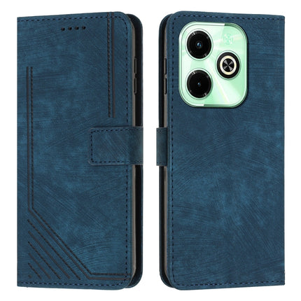 Skin Feel Stripe Pattern Leather Phone Case with Lanyard, For Infinix Note 40 4G, For Infinix Hot 40 / 40 Pro, For Infinix Hot 40i, For Infinix Smart 8
