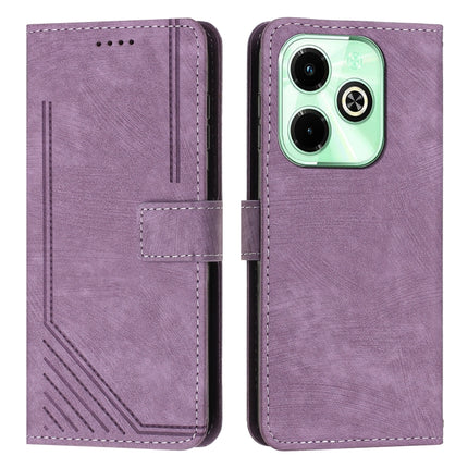 Skin Feel Stripe Pattern Leather Phone Case with Lanyard, For Infinix Note 40 4G, For Infinix Hot 40 / 40 Pro, For Infinix Hot 40i, For Infinix Smart 8