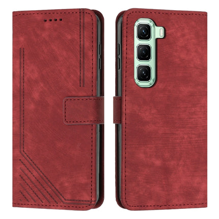 Skin Feel Stripe Pattern Leather Phone Case with Lanyard, For Infinix Note 50 Pro+, For Infinix Note 50 4G / 50 Pro 4G, For Infinix Hot 50 Pro 4G, For Infinix Hot 50i