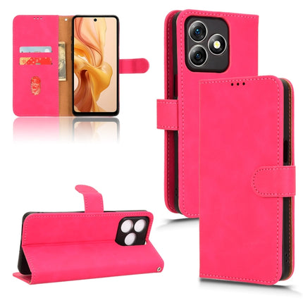 Skin Feel Magnetic Flip Leather Phone Case, For Ulefone Note 18 Ultra, For Ulefone Note 15, For Ulefone Note 16 Pro