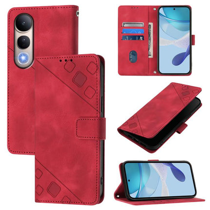Skin-feel Embossed Leather Phone Case, For Honor Power 5G, For Honor Play 60 5G, For Honor 400 Lite Global, For Honor 400 Global 156.5mm