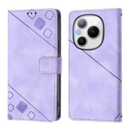 Skin-feel Embossed Leather Phone Case, For Honor Power 5G, For Honor Play 60 5G, For Honor 400 Lite Global, For Honor 400 Global 156.5mm
