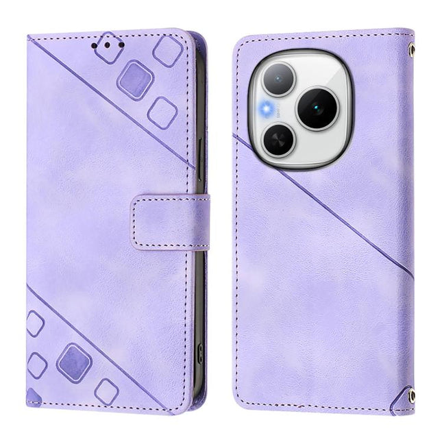 Skin-feel Embossed Leather Phone Case, For Honor Power 5G, For Honor Play 60 5G, For Honor 400 Lite Global, For Honor 400 Global 156.5mm