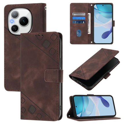 Skin-feel Embossed Leather Phone Case, For Honor Power 5G, For Honor Play 60 5G, For Honor 400 Lite Global, For Honor 400 Global 156.5mm