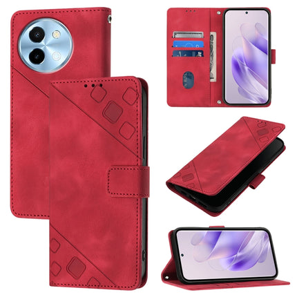 Skin Feel Embossed Leather Phone Case, For vivo Y28 4G, For vivo X100s 5G, For vivo Y38 5G, For vivo V30e 5G Global