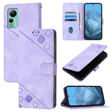 Skin Feel Embossed Leather Phone Case, For Ulefone Note 14