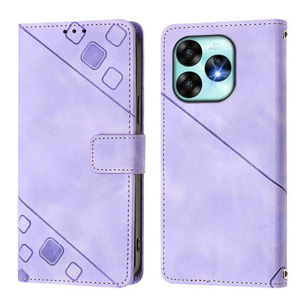 Skin-feel Embossed Leather Phone Case, For Umidigi A15 / A15C / A15T, For UMIDIGI Power 7 / Power 7S, For UMIDIGI Power 7 Max