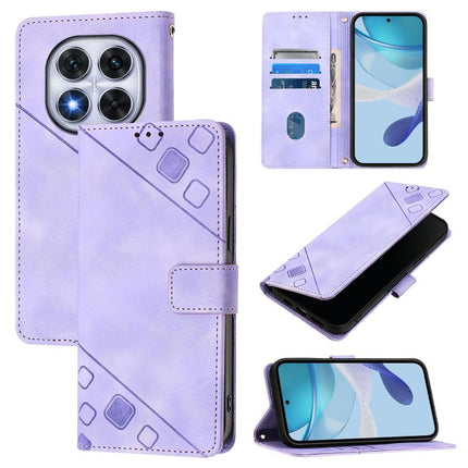 Skin-feel Embossed Leather Phone Case, For Xiaomi Poco X7 5G, For Xiaomi 15 Ultra, For Xiaomi Poco X7 Pro 5G, For Xiaomi Poco M7 Pro 5G Global