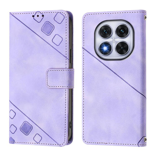 Skin-feel Embossed Leather Phone Case, For Xiaomi Poco X7 5G, For Xiaomi 15 Ultra, For Xiaomi Poco X7 Pro 5G, For Xiaomi Poco M7 Pro 5G Global