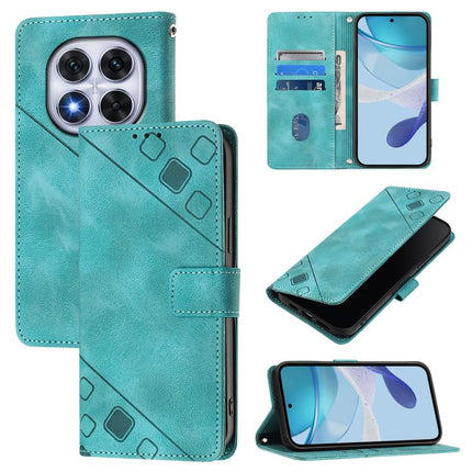 Skin-feel Embossed Leather Phone Case, For Xiaomi Poco X7 5G, For Xiaomi 15 Ultra, For Xiaomi Poco X7 Pro 5G, For Xiaomi Poco M7 Pro 5G Global