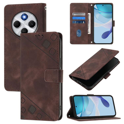 Skin-feel Embossed Leather Phone Case, For Xiaomi 15T 5G, For Xiaomi Civi 5 Pro 5G, For Xiaomi 15S Pro 5G, For Xiaomi Poco M7 5G / C75 4G
