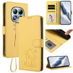For Redmi Note 15 Pro+ 5G 163.3mm/Poco M8 Pro 5G / Yellow