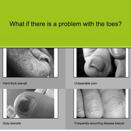 2 in 1 Nail Clipper for Paronychia Stainless Steel Olecranon Nail Nipper & Ingrown Nail Lifter