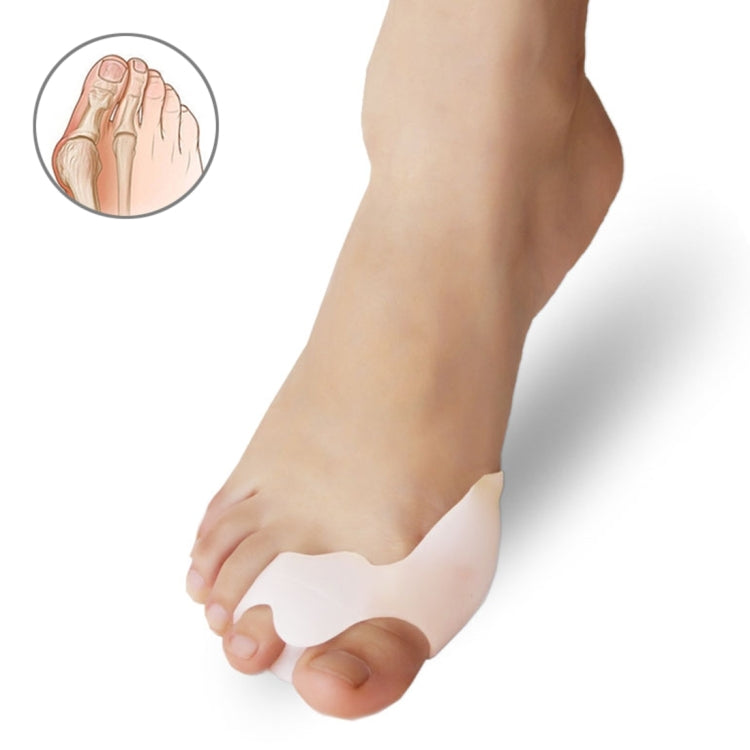 1 Pair ZRWC16B Special Orthopedic Braces for Hallux valgus, Big Bone, Bicyclic Thumb