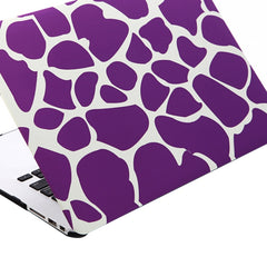 Funda protectora rígida de plástico esmerilado para MacBook Air de 11,6 pulgadas, S-MAC-0022A, S-MAC-0022B, S-MAC-0022C, S-MAC-0022D, S-MAC-0022E