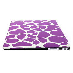 Funda protectora rígida de plástico esmerilado para MacBook Air de 11,6 pulgadas, S-MAC-0022A, S-MAC-0022B, S-MAC-0022C, S-MAC-0022D, S-MAC-0022E