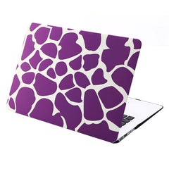 Funda protectora rígida de plástico esmerilado para MacBook Air de 11,6 pulgadas, S-MAC-0022A, S-MAC-0022B, S-MAC-0022C, S-MAC-0022D, S-MAC-0022E