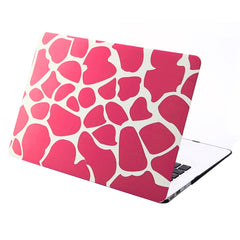 Funda protectora rígida de plástico esmerilado para MacBook Air de 11,6 pulgadas, S-MAC-0022A, S-MAC-0022B, S-MAC-0022C, S-MAC-0022D, S-MAC-0022E