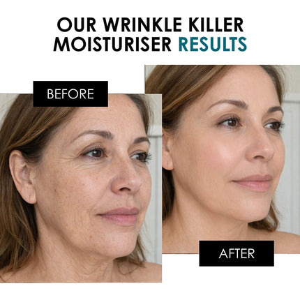 SC Wrinkle Killer Night Moisturiser 50ml