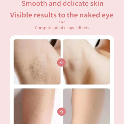 Multipurpose Electric Hair Remover For Women Epilator Trimmer Face Shavers Hair Razors For Underarms Legs Ladies Body Trimmer