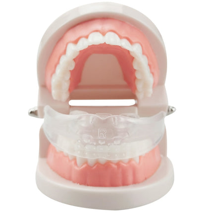 Orthodontic Appliance Silicone Simulation Braces Anti-molar Braces for Night, The first stage, The second stage, The third stage