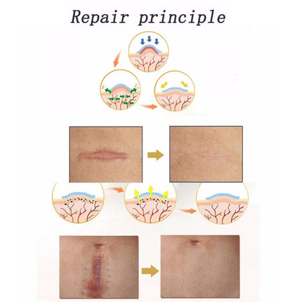 Organic silicone Gel Scar Therapy Patch  be Washed and Reused