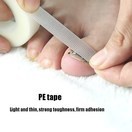 Orthopedic Buckle Toe Nail Groove Ingrown Nail Corrector, No. 36 Positive Nail Buckle, No. 38 Positive Nail Buckle, No. 40 Positive Nail Buckle, No. 42 Positive Nail Buckle, No. 44 Positive Nail Buckle, No. 36 Set, No. 38 Set, No. 40 Set, No. 42 Set   ...