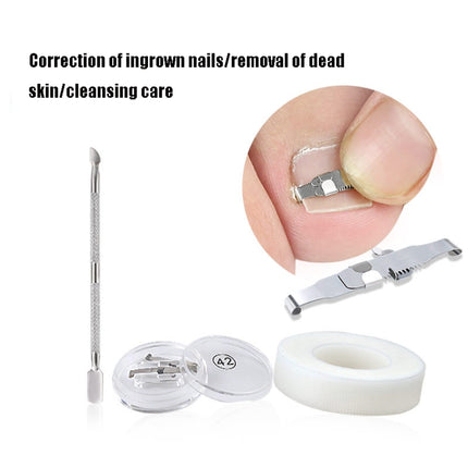 Orthopedic Buckle Toe Nail Groove Ingrown Nail Corrector, No. 36 Positive Nail Buckle, No. 38 Positive Nail Buckle, No. 40 Positive Nail Buckle, No. 42 Positive Nail Buckle, No. 44 Positive Nail Buckle, No. 36 Set, No. 38 Set, No. 40 Set, No. 42 Set   ...