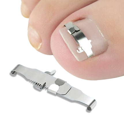 Orthopedic Buckle Toe Nail Groove Ingrown Nail Corrector, No. 36 Positive Nail Buckle, No. 38 Positive Nail Buckle, No. 40 Positive Nail Buckle, No. 42 Positive Nail Buckle, No. 44 Positive Nail Buckle, No. 36 Set, No. 38 Set, No. 40 Set, No. 42 Set   ...
