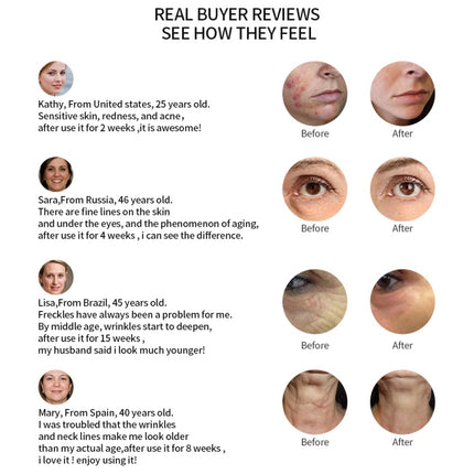 Radio Mesotherapy Electroporation Face Beauty Pen Radio Frequency LED Photon Face Skin Rejuvenation Remover Wrinkle