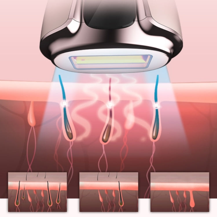 Ladies Laser Hair Removal Device Home IPL Photon Electric Skin Rejuvenation Device