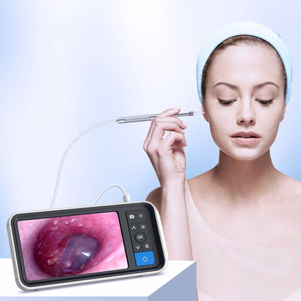 TESLONG MS450 4.5 inch HD Smart Screen Otoscope with 32GB Memory Card, MS450