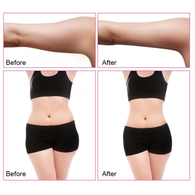 3-in-1 40K Ultrasonic Fat Blasting Device  Radio Frequency Beauty Device