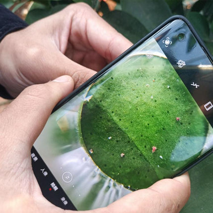Skin Hair Follicles Scalp Macro Magnifier For Mobile Phones